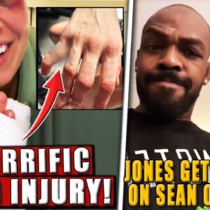 Rose Namajunas SHOWS OFF HORRIFIC hand injury! Jon Jones GETS HONEST on Sean O'Malley! Dana-Merab