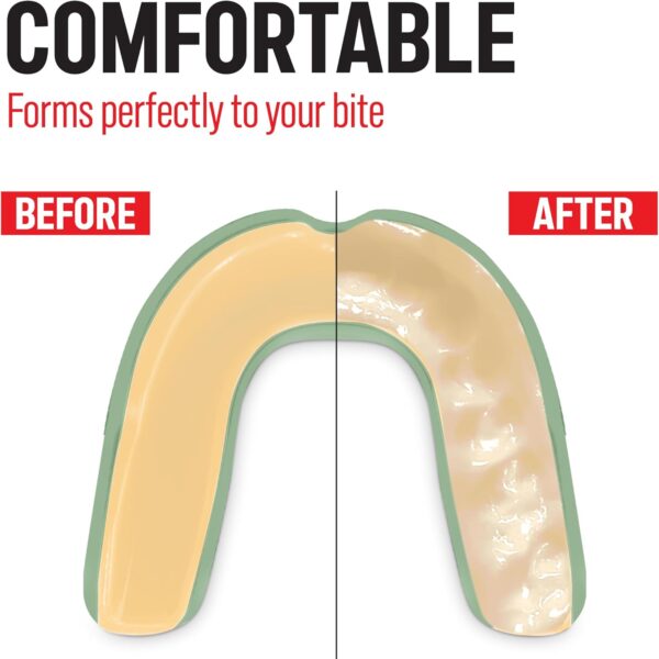 Professional Sports Mouth Guard for Boxing, MMA, Football - Adult & Kids - Image 5