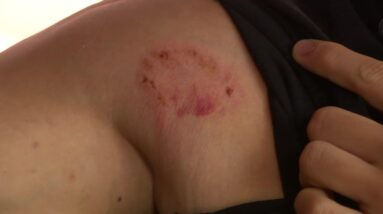 6p pkg restaurant worker attacked wcco8e6l 00 01 1204